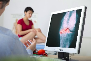 diagnosticul de osteoartrita