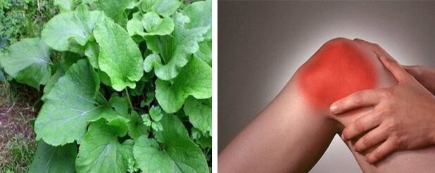 Beneficiile brusturei pentru artroza articulației genunchiului