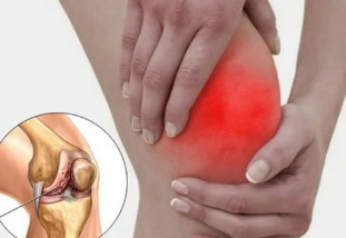 Ce se întâmplă când artrita